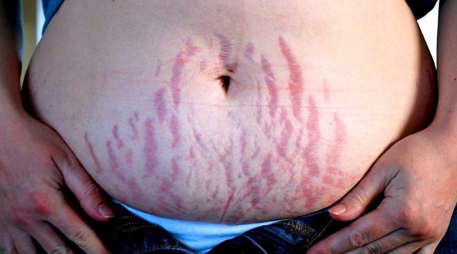 Çatlakların Bitkisel Tedavisi, Doğal Çözümü