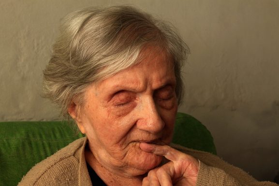 Alzheimer'ın tanımı, belirtisi ve tedavisi