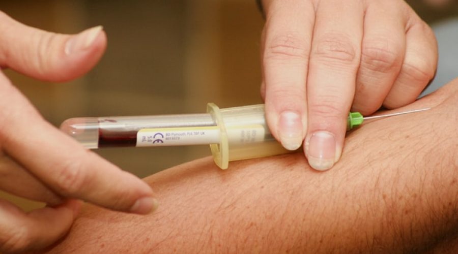 Bombay kan grubu (hh kan grubu) nedir, sağlığı olumsuz etkiler mi?